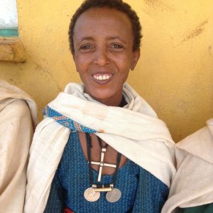 Deberie, podo patient on her first day of treatment